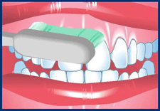 Toothbrush brushing the front surfaces of upper and lower teeth.