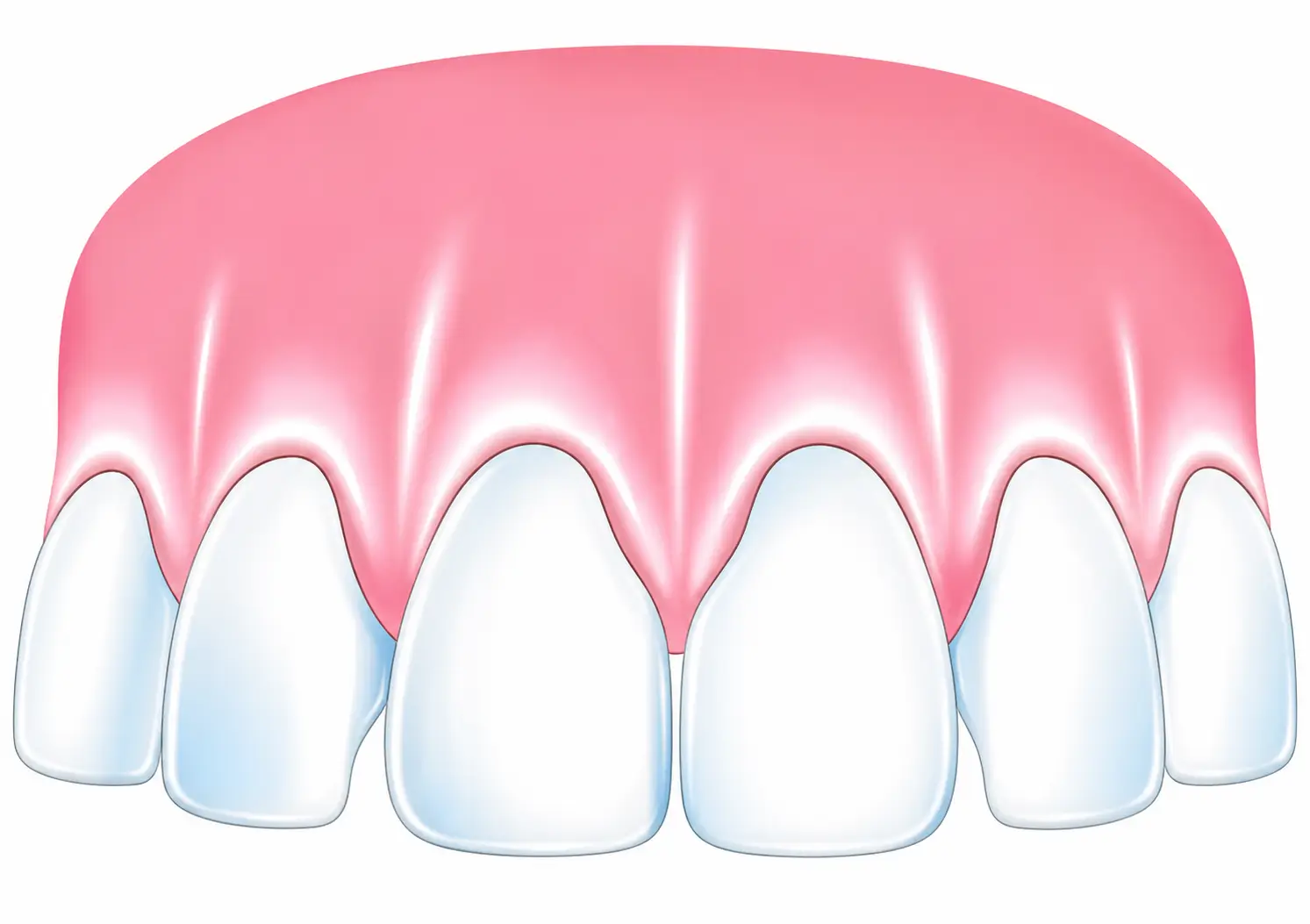 Illustration of upper front teeth and pink gums showing healthy gum tissue.